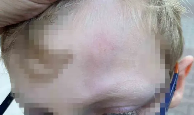 Beylikdüzü'nde okulda öğrenciye demir çubukla darp iddiası