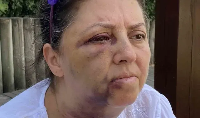 Küçükçekmece'de kedi besleyen iki kız kardeşi komşularının saldırısına uğradı