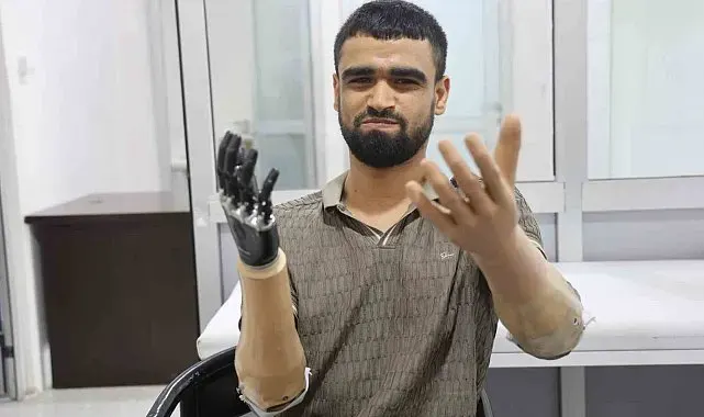 Demirin elektrik tellerine değmesiyle hayatı kararan Muhammed, 3 milyon TL değerindeki protez bacağına ve 2 biyonik koluna kavuştu