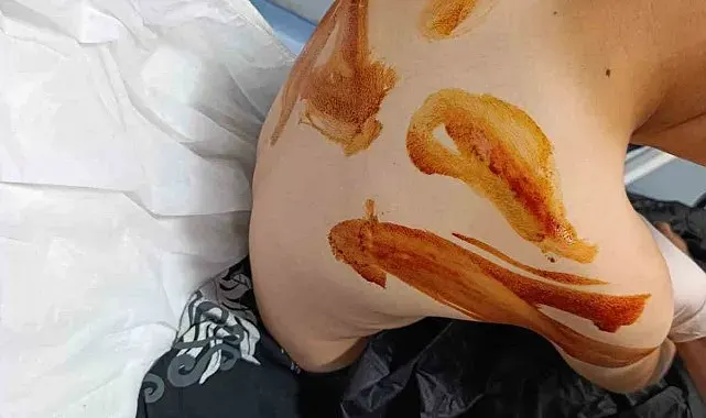 Şanlıurfa'da 11 yaşındaki çocuğa öldüresiye dayak