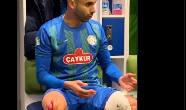 Çaykur Rizespor, Rachid Ghezzal'ın darbe alan ayağının fotoğrafını paylaştı