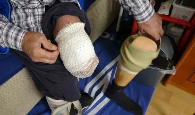 Bir zamanlar mahallenin neşesiydi şimdi evden dışarı çıkamıyor